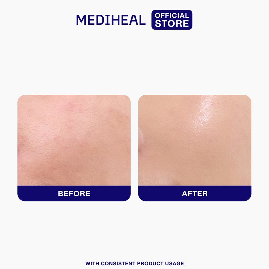 MEDIHEAL Madecassoside Blemish Repair Serum image