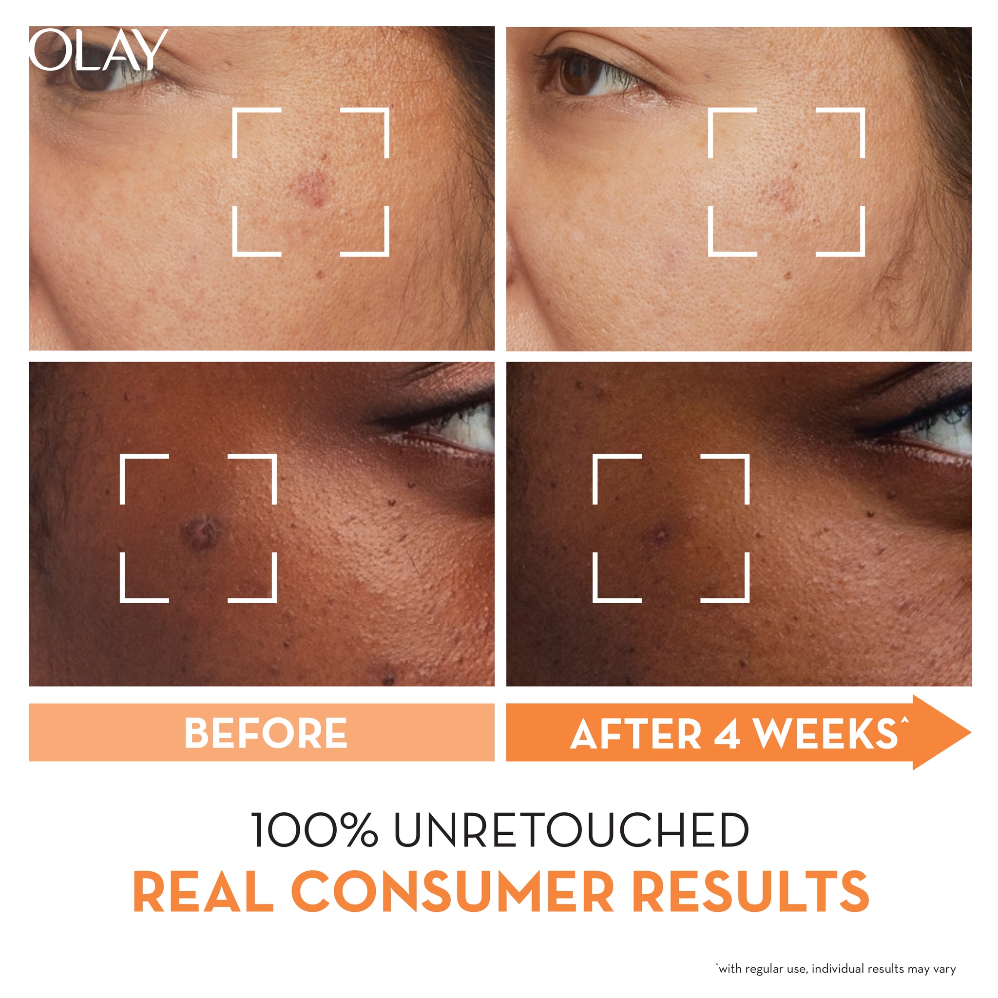 OLAY VIT C RETINOL SERUM BUNDLE image