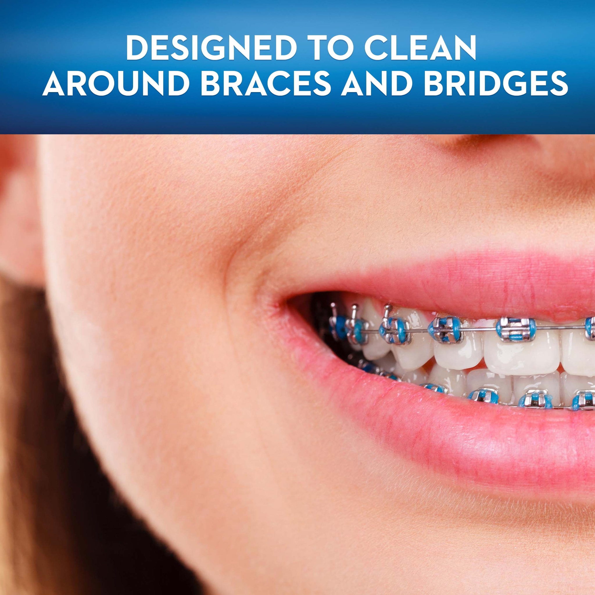 Orthodontic Toothbrush