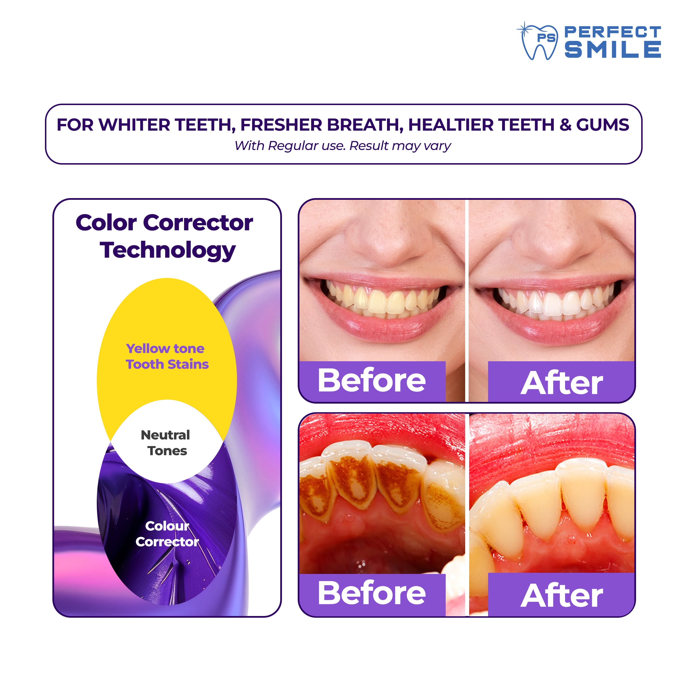 PERFECT SMILE Purple White Stain Removing Toothpaste Value Pack 2s 120ml