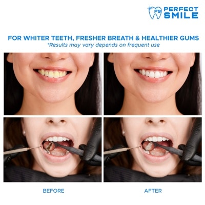 PERFECT SMILE Teeth Whitening Oral Rinse Refill 500ml