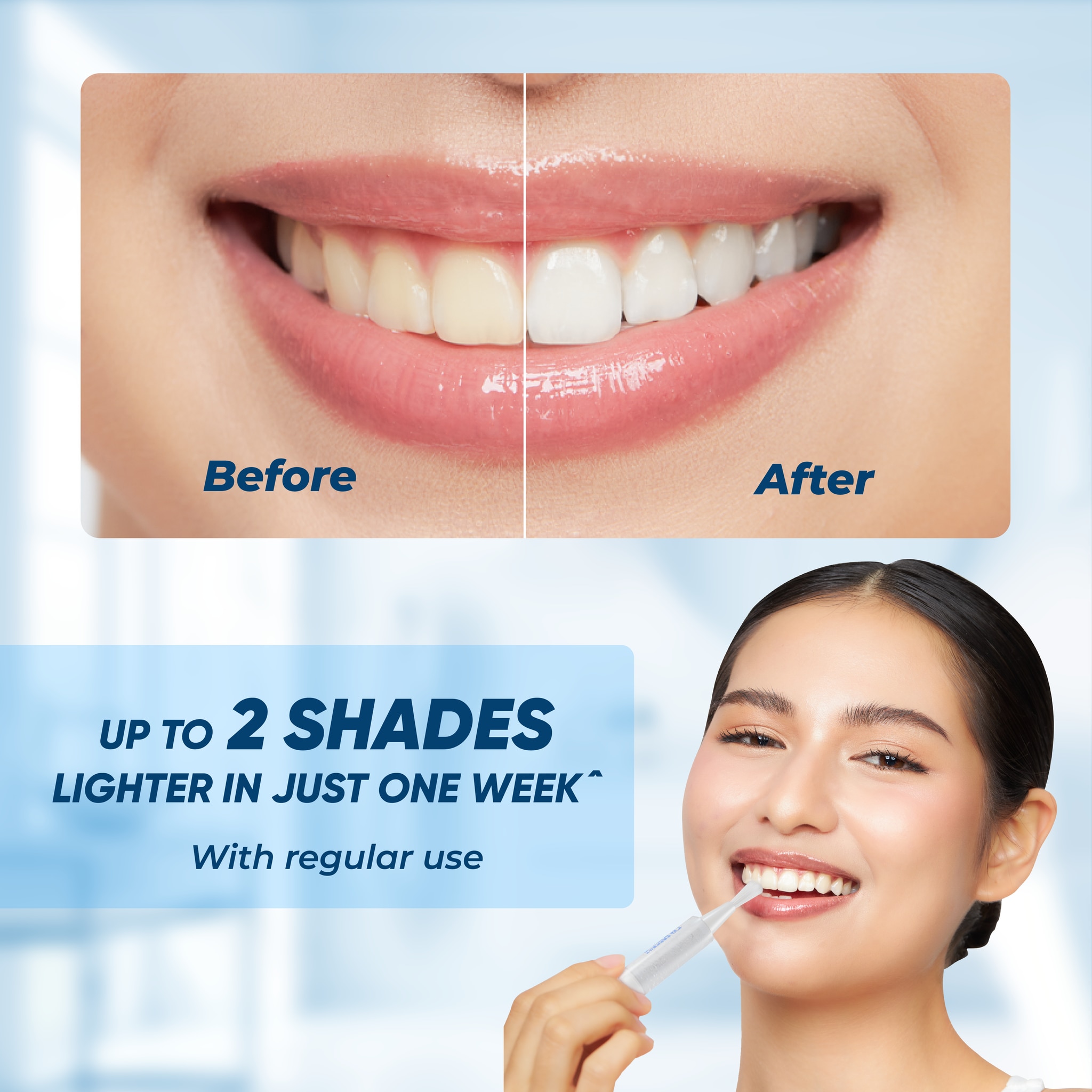 Teeth Whitening Pen 4ml