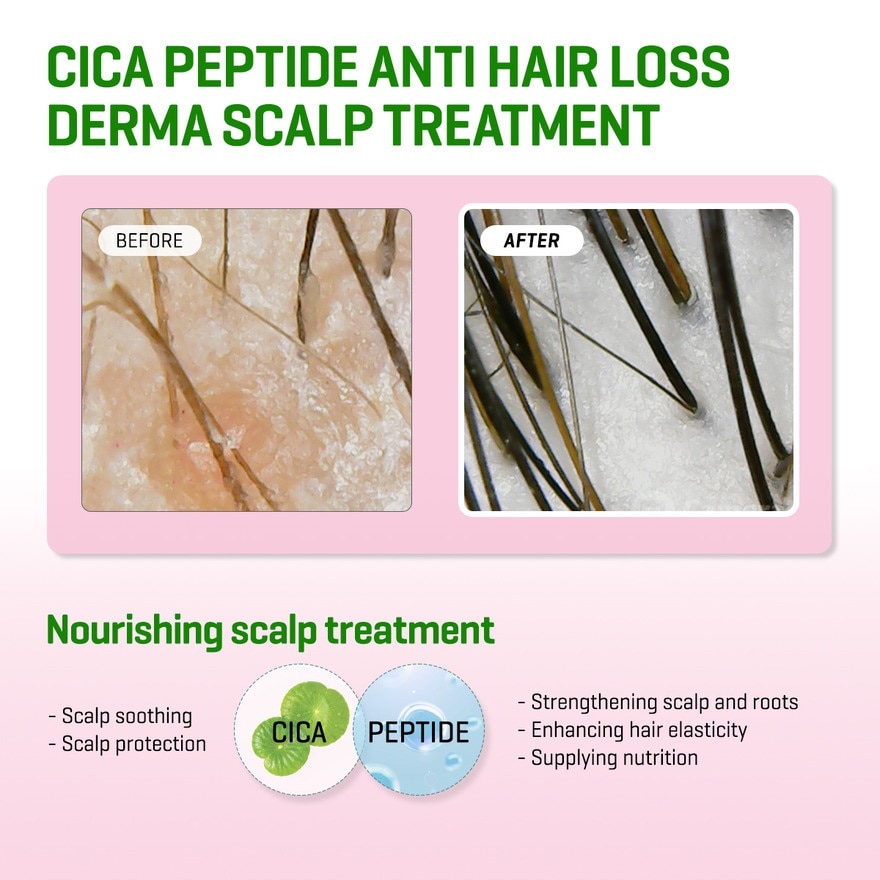 SOME BY MI Cica Peptide Anti Hair Loss Derma Scalp Treatment 50ml