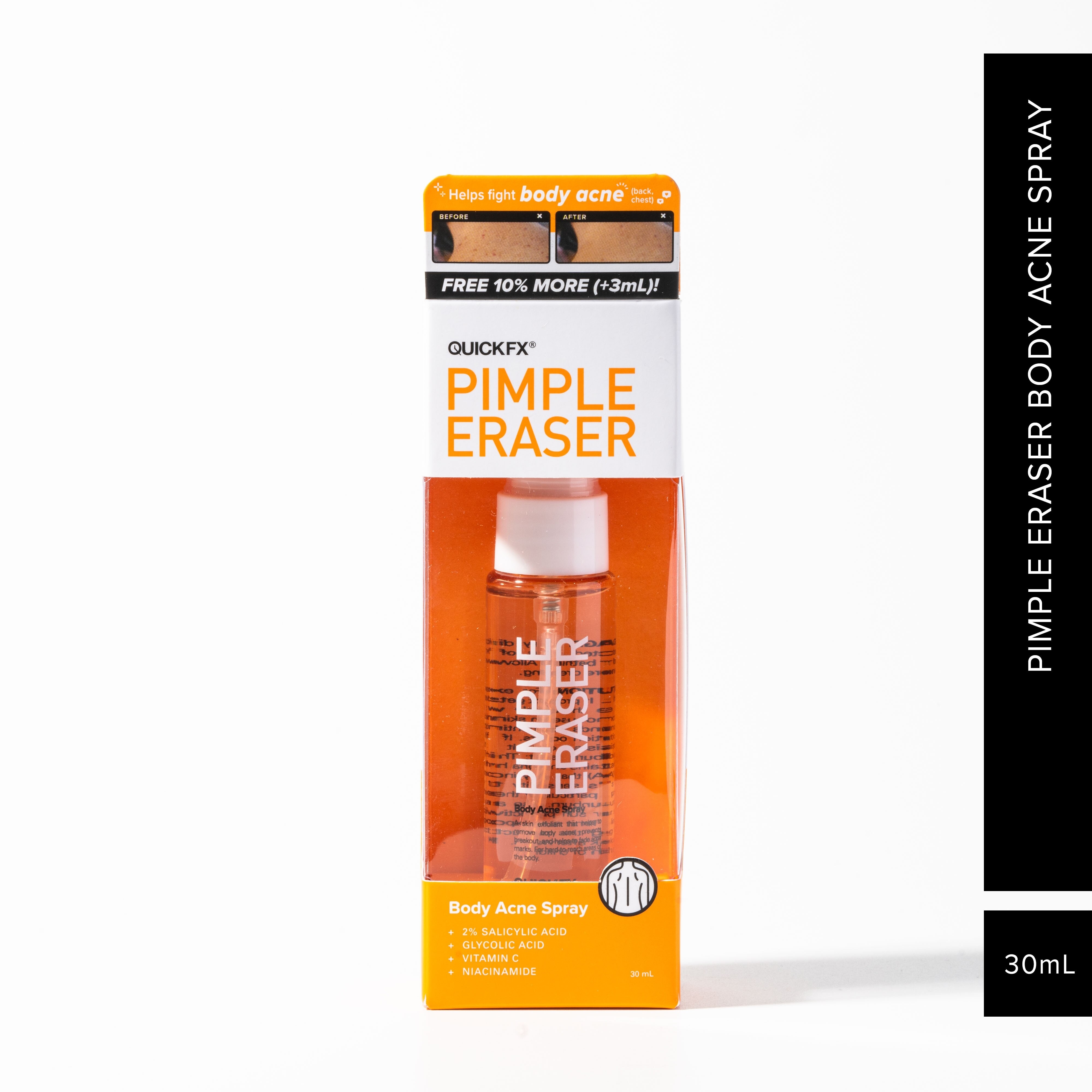 Pimple Eraser Body Acne Spray 30ML