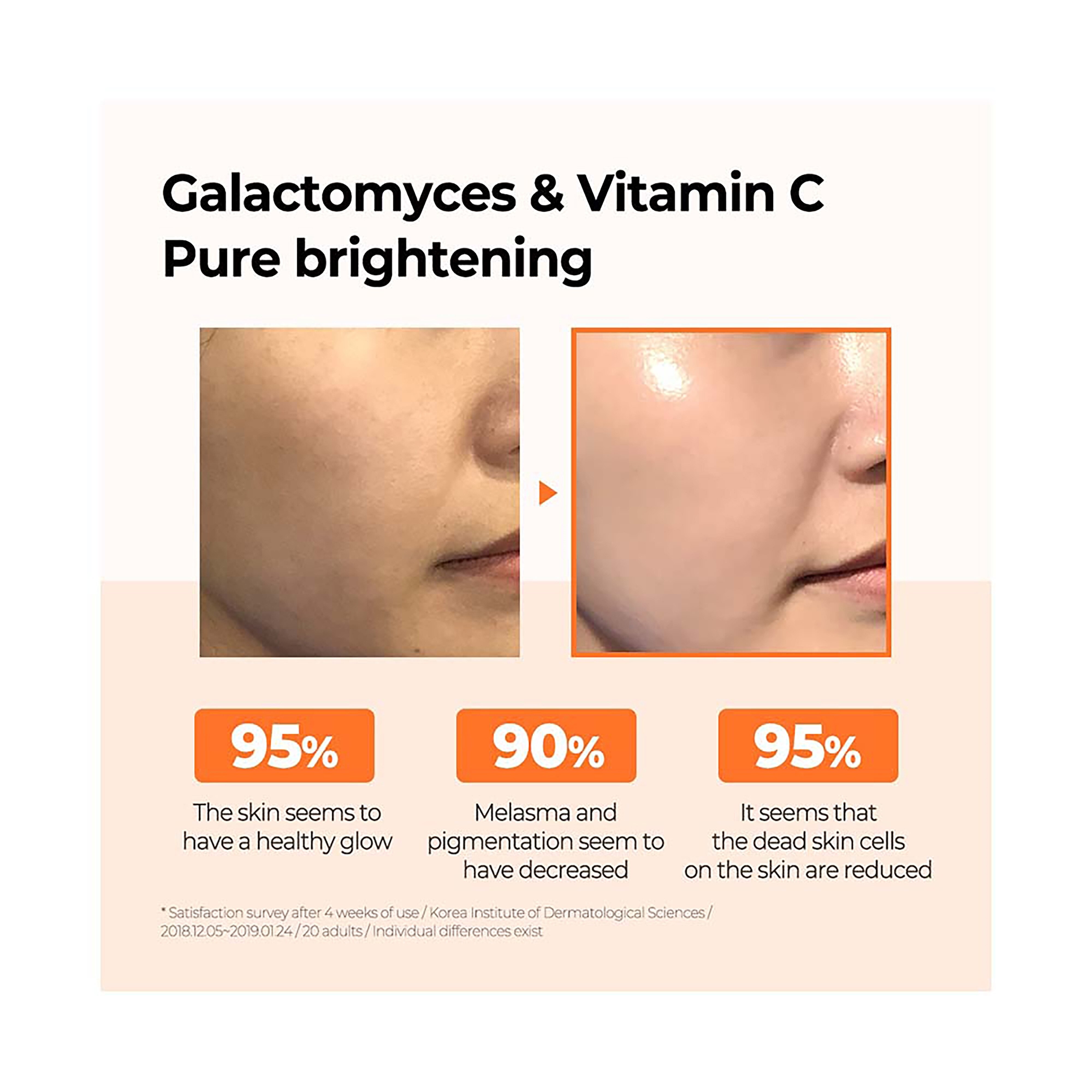 SOME BY MI Galactomyces Pure Vitamin C Glow Serum 30ML