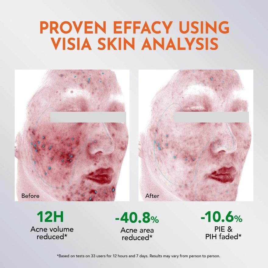 Y.O.U Acneplus Spot Care Pro Serum 15g image