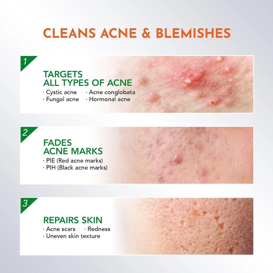 Y.O.U Acneplus Spot Care Pro Serum 15g image