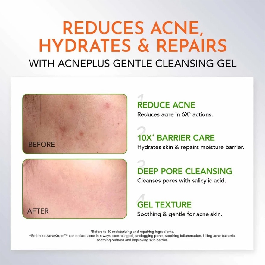 Y.O.U AcnePlus Gentle Cleansing Gel 100g image