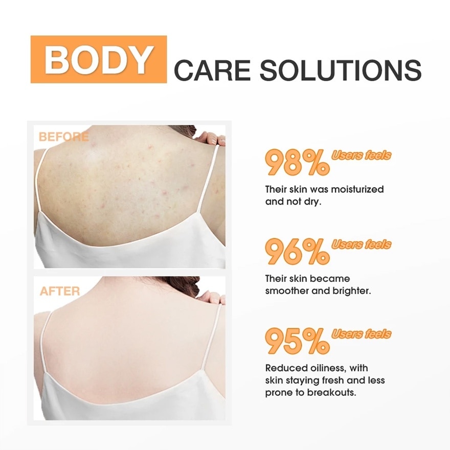 SKINEVER Salicylic Acid Weightless Exfoliating Body Lotion 100ml image