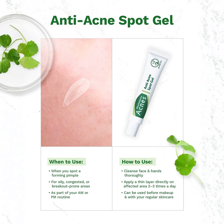 Anti Acne Spot Gel - 18 G