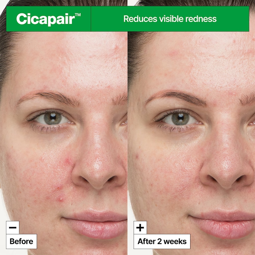 DR JART Cicapair So Soothing Treatment 30ml image