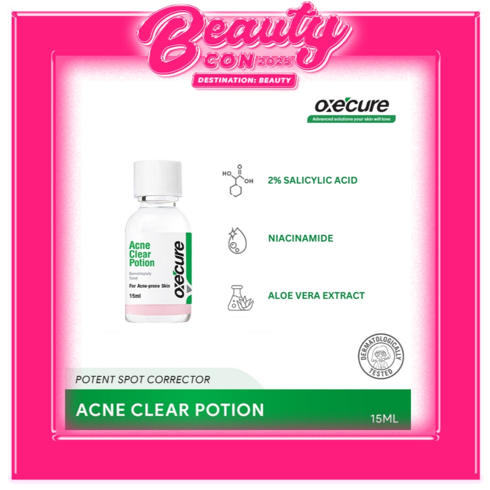 Acne Clear Potion - 15 ML