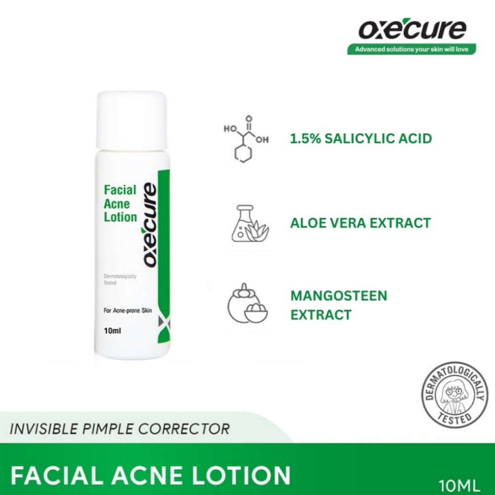 Facial Acne Lotion - 10 ML