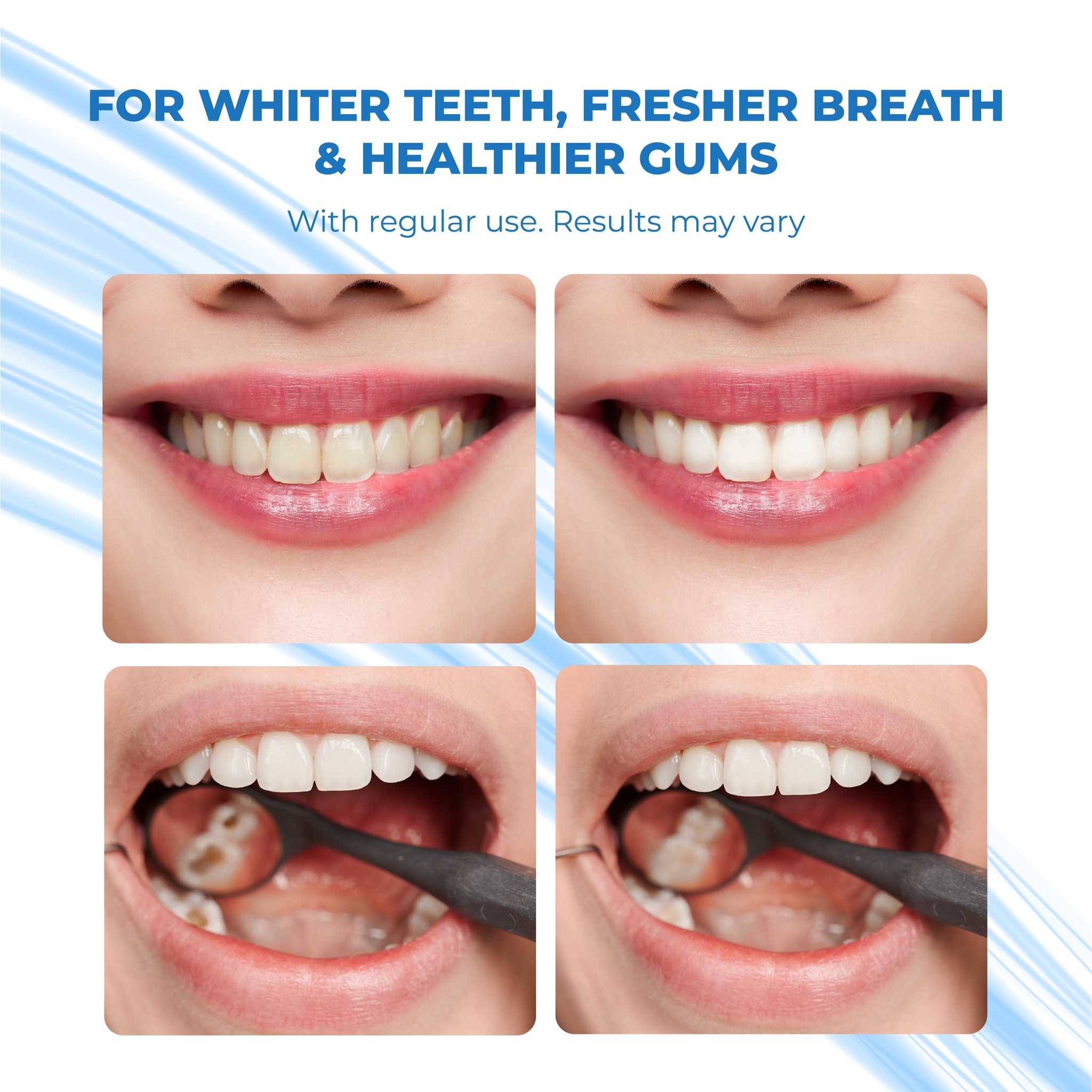 PERFECT SMILE 4in1 Extreme White Premium Whitening Toothpaste Original 120g x2